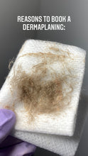 Load image into Gallery viewer, Dermaplaning