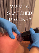 Load image into Gallery viewer, Morpheus Microneedling + Radiofrequency