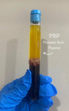 Load image into Gallery viewer, Skinpen Microneedling + PRP