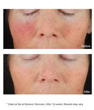Load image into Gallery viewer, Revision Skincare Vitamin C+ Correcting Complex
