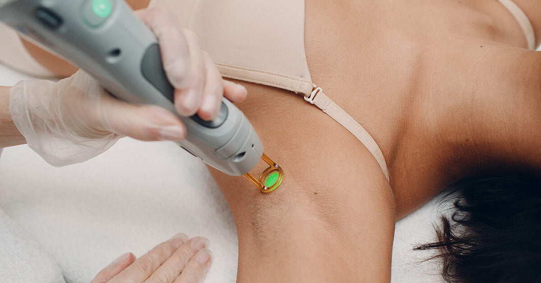 Laser Hair Removal